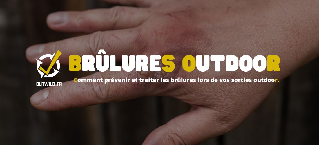 Comment prévenir et traiter les brûlures lors de vos sorties outdoor